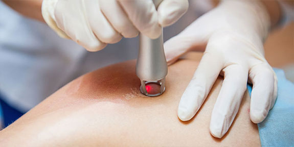Laser treatment at Center For Auto Accident Injury Treatment in Louisville